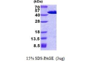 SDS-PAGE (SDS) image for Fibroblast Growth Factor (Acidic) Intracellular Binding Protein (FIBP) (AA 1-364) protein (His tag) (ABIN5853020)