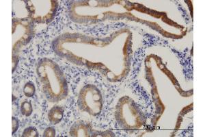 Immunoperoxidase of monoclonal antibody to CPS1 on formalin-fixed paraffin-embedded human small Intestine. (CPS1 antibody  (AA 1400-1500))