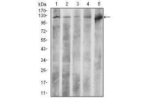 Image no. 4 for anti-ATP Citrate Lyase (ACLY) antibody (ABIN1491378) (ACLY antibody)