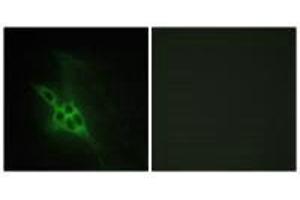 Immunofluorescence analysis of NIH/3T3 cells, using EPHB1/2/3 antibody. (EPH Receptor B1 antibody)