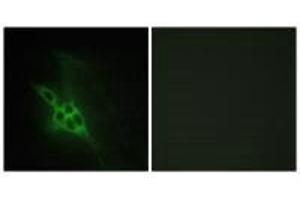 Immunofluorescence analysis of NIH/3T3 cells, using EPHB1/2/3 antibody. (EPHB1/EPHB2/EPHB3 antibody)