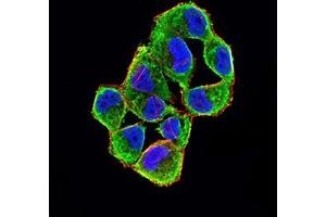 Immunofluorescence analysis of Hela cells using CDKN2A/P16 mouse mAb (green). (Tumor Suppressor ARF (CDKN2A) (AA 1-156) antibody)