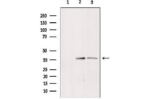 Western blot analysis of extracts from various samples, using BNIP2 Antibody. (BNIP2 antibody  (Internal Region))