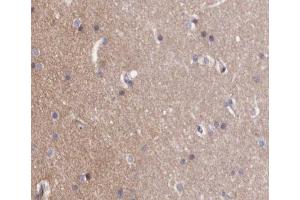 ABIN6267257 at 1/200 staining human brain tissue sections by IHC-P. (ABL1 antibody  (pTyr412))