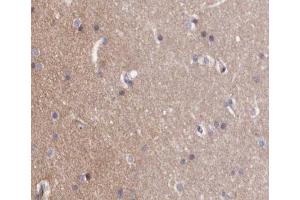 ABIN6267257 at 1/200 staining human brain tissue sections by IHC-P.