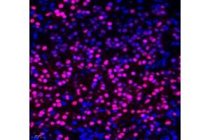 Immunofluorescence of paraffin embedded mouse embryonic mouse using OTX2 (ABIN7074952) at dilution of 1:600 (400x lens) (OTX2 antibody)
