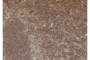ABIN6254874 and ABIN6276920 at 1/100 staining Mouse spleen tissue by IHC-P.