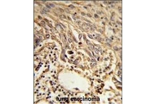 EIF4A2 antibody  (C-Term)