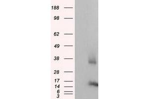 Western Blotting (WB) image for anti-CDGSH Iron Sulfur Domain 1 (CISD1) antibody (ABIN1497521) (CISD1 antibody)