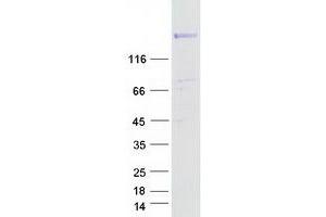 RAPGEF6 Protein (Myc-DYKDDDDK Tag)