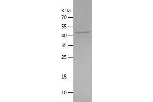 Western Blotting (WB) image for Runt-Related Transcription Factor 2 (RUNX2) (AA 92-306) protein (His-IF2DI Tag) (ABIN7124937) (RUNX2 Protein (AA 92-306) (His-IF2DI Tag))