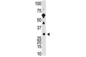Image no. 1 for anti-Recoverin (RCVRN) (C-Term) antibody (ABIN357114) (Recoverin antibody  (C-Term))
