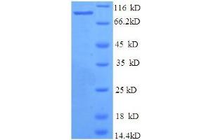 SDS-PAGE (SDS) image for Bone Morphogenetic Protein 1 (BMP1) (AA 121-986) protein (His tag) (ABIN4975919) (BMP1 Protein (AA 121-986) (His tag))