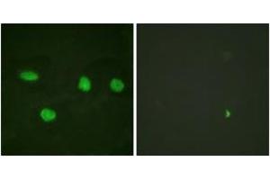 Immunofluorescence analysis of HeLa cells, using 53BP1 (Ab-6) Antibody. (TP53BP1 antibody  (AA 1-50))