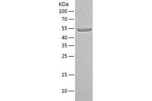 Western Blotting (WB) image for Peroxisome Proliferator-Activated Receptor gamma (PPARG) (AA 1-505) protein (His tag) (ABIN7286060) (PPARG Protein (AA 1-505) (His tag))