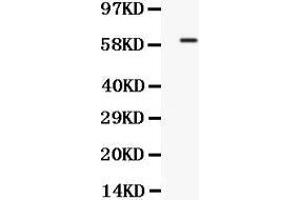 Western blot analysis of TCF7L1 expression in COLO320 whole cell lysates (lane 1). (TCF7L1 antibody  (C-Term))