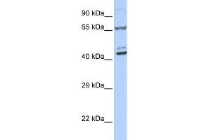WB Suggested Anti-ZNF324 Antibody Titration:  0. (ZNF324 antibody  (Middle Region))