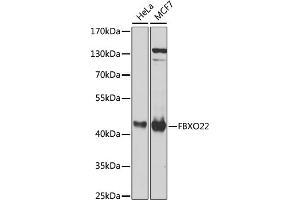 Western blot analysis of extracts of various cell lines, using FBXO22 antibody (ABIN6131311, ABIN6140516, ABIN6140517 and ABIN6224399) at 1:1000 dilution. (FBXO22 antibody  (AA 104-403))