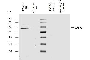 Western blotting analysis of human ZAP70 using rabbit polyclonal antibody PAb (430) on lysates of MOLT-4 cell line and HEK293T/17 cell line (ZAP70 non-expressing cell line, negative control) under non-reducing and reducing conditions.