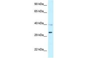 Image no. 1 for anti-Tumor Necrosis Factor Receptor Superfamily, Member 14 (TNFRSF14) (AA 118-167) antibody (ABIN6747535)