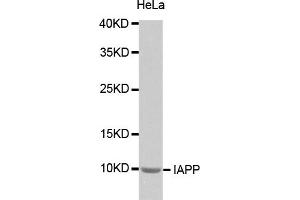 Western blot analysis of extracts of HeLa cells, using IAPP antibody (ABIN2974276). (Amylin/DAP antibody)