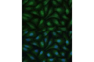 Immunofluorescence analysis of U-2 OS cells using D Polyclonal Antibody (ABIN7266712) at dilution of 1:100 (40x lens).