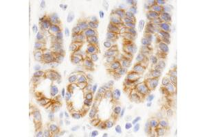 Immunohistochemistry (IHC) image for anti-C2 Calcium Dependent Domain Containing 5 (C2CD5) (AA 375-425) antibody (ABIN7454753) (C2CD5/KIAA0528 antibody  (AA 375-425))