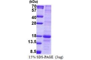 SDS-PAGE (SDS) image for Lymphocyte Antigen 86 (LY86) (AA 21-162) protein (His tag) (ABIN5853100)