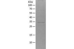 Western Blotting (WB) image for BCL2-Associated X Protein (BAX) (AA 1-110) protein (His-IF2DI Tag) (ABIN7282109) (BAX Protein (AA 1-110) (His-IF2DI Tag))
