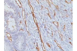 Immunohistochemistry (IHC) image for anti-Platelet/endothelial Cell Adhesion Molecule (PECAM1) antibody (ABIN6940285)
