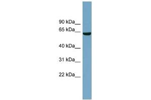 WB Suggested Anti-SLC5A8 Antibody Titration:  0. (SLC5A8 antibody  (Middle Region))