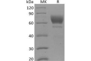 Western Blotting (WB) image for Tyrosine protein (His tag) (ABIN7320893) (Tyrosine protein (His tag))