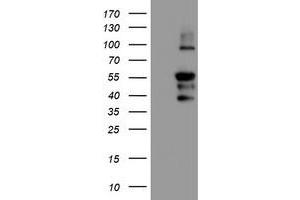 Western Blotting (WB) image for anti-Protein Phosphatase 1, Regulatory (Inhibitor) Subunit 15A (PPP1R15A) antibody (ABIN1498364) (GADD34 antibody)
