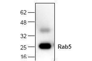 Image no. 1 for anti-RAB5A, Member RAS Oncogene Family (RAB5A) antibody (ABIN127153) (RAB5 antibody)
