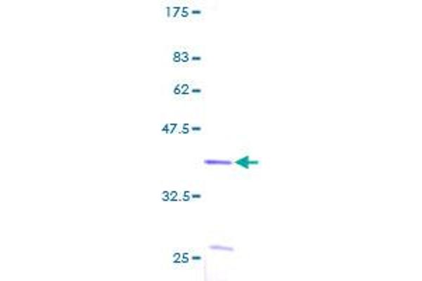 S100A2 Protein (AA 1-97) (GST tag)