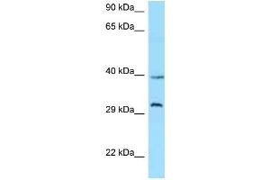 WB Suggested Anti-GHSR Antibody Titration: 1. (GHSR antibody  (C-Term))