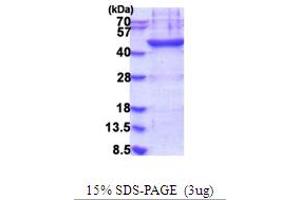 SDS-PAGE (SDS) image for Lipoprotein-Associated phospholipase A2 (Lp-PLA2) (AA 47-441) protein (His tag) (ABIN5854006) (PLA2G7 Protein (AA 47-441) (His tag))