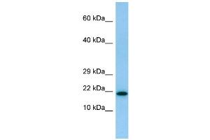 WB Suggested Anti-IL26 Antibody Titration: 1. (IL-26 antibody  (N-Term))