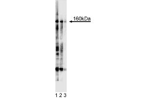 Western blot analysis for Tie2. (TEK antibody  (Extracellular Domain))