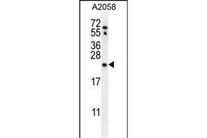 Western blot analysis in A2058 cell line lysates (35ug/lane). (RAB10 antibody  (AA 89-117))