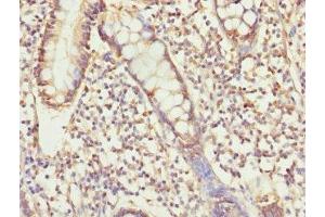 Immunohistochemistry of paraffin-embedded human small intestine tissue using ABIN7174300 at dilution of 1:100 (USP26 antibody  (AA 664-913))