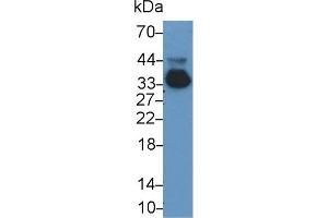 Detection of APOE in Rat Serum using Monoclonal Antibody to Apolipoprotein E (APOE) (APOE antibody  (AA 19-168))