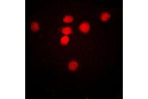 Immunofluorescent analysis of MRE11 staining in HeLa cells. (Mre11 antibody  (Center))