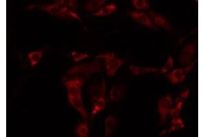 ABIN6275043 staining NIH-3T3 by IF/ICC. (GARP antibody  (Internal Region))