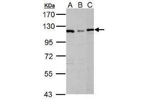 WB Image Sample (30 ug of whole cell lysate) A: Raji B: K562 C: NCI-H929 7. (DPYD antibody)