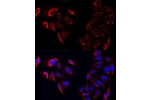 Immunofluorescence analysis of U2OS cells using SAA3 antibody. (Serum Amyloid A3 Pseudogene (SAA3P) antibody)