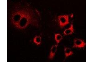 Immunofluorescent analysis of LIM staining in HepG2 cells. (PDLIM5 antibody)