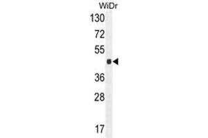 AMAC1L2 antibody  (N-Term)