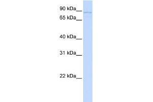 WB Suggested Anti-SLITRK6 Antibody Titration:  0. (SLITRK6 antibody  (N-Term))