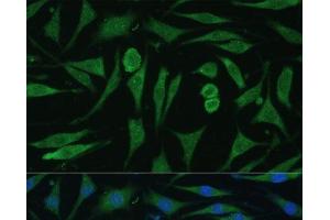 Immunofluorescence analysis of L929 cells using GAPVD1 Polyclonal Antibody at dilution of 1:100.